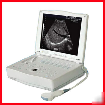 New laptop ultrasound scanner with convex probe