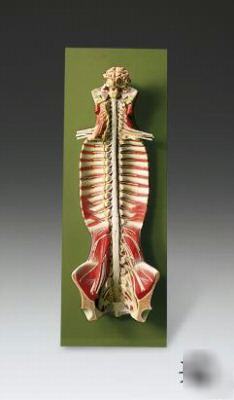 Spinal cord in spinal canal anatomical model #2117STEM*