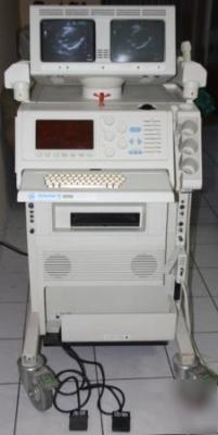 Ultrasound machine atl ultramart 9