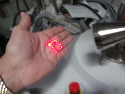 Sciton erbium laser