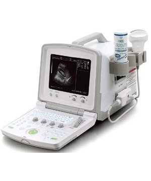 Digital portable ultrasound b-ultrasound convex probe 
