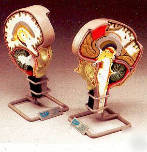 Brain- 2 sided segmented anatomical model lfa # 2114*