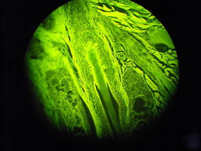 Olympus bhtu fluorescence microscope with 5 plan obj.