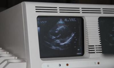 Ultrasound machine atl ultramart 9