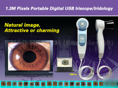 1.3M pixels portable usb pc digital iriscope iridology