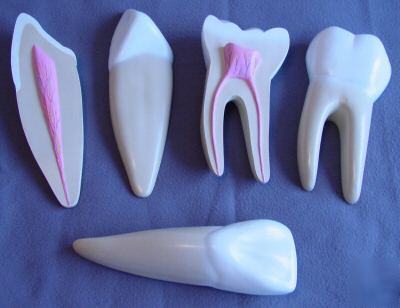 New giant anatomical tooth model, 5PCS 