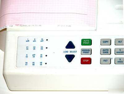 Welch allyn schiller cardiovit at-2 ekg interpretive 