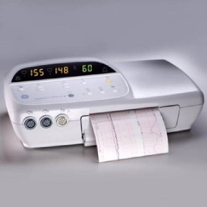 Corometrics 170 series fetal monitor/ model 172 $5700