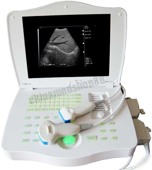 Portalble ultrasound scanner system+2PROBE+printer