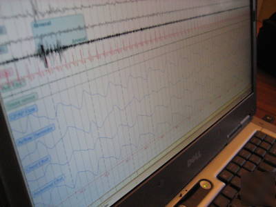 Sleep apnea diagnostic testing digital ambulatory 