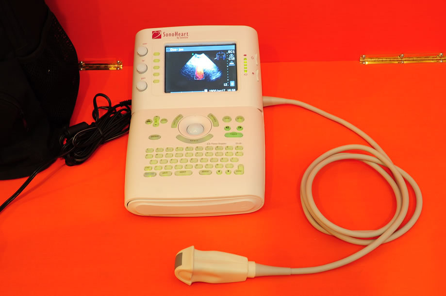 Sonosite sonoheart hand-carried echocardiography system