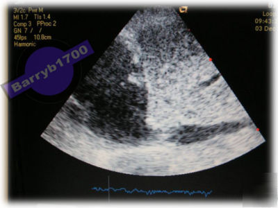 Acuson cypress portable ultrasound machine with 3V-2C
