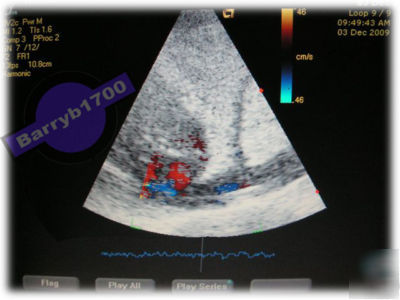 Acuson cypress portable ultrasound machine with 3V-2C