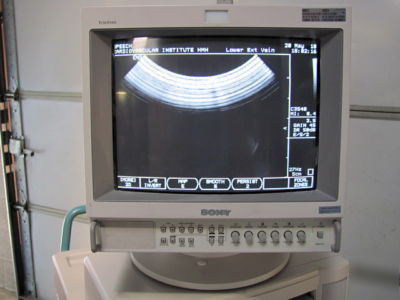 Hp image point hx ultrasound pr:C3540/ C6514/ L7535/ S4