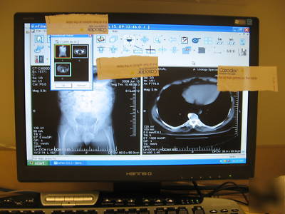Phillips neusoft ct C3000 dual slice ct scanner