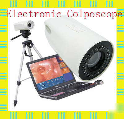 Sony 600,000/800,000PIXELS electronic colposcope camera
