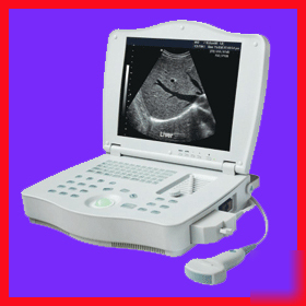 New full digital laptop ultrasound scanner convex probe