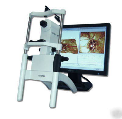 Heidelberg hrtii retinal tomograph glaucoma tomographer