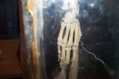 Real human skelton in plexiglass case