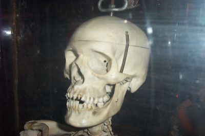 Real human skelton in plexiglass case