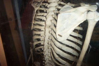 Real human skelton in plexiglass case