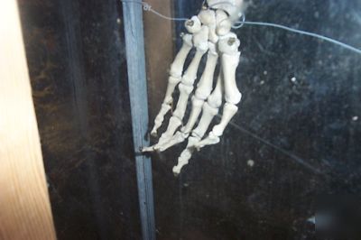 Real human skelton in plexiglass case