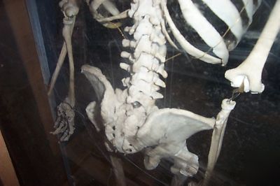 Real human skelton in plexiglass case