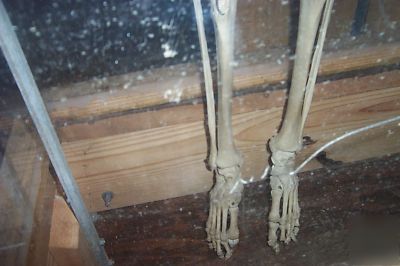 Real human skelton in plexiglass case
