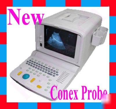 New ultrasound scanner ultrasound machine+convex probe